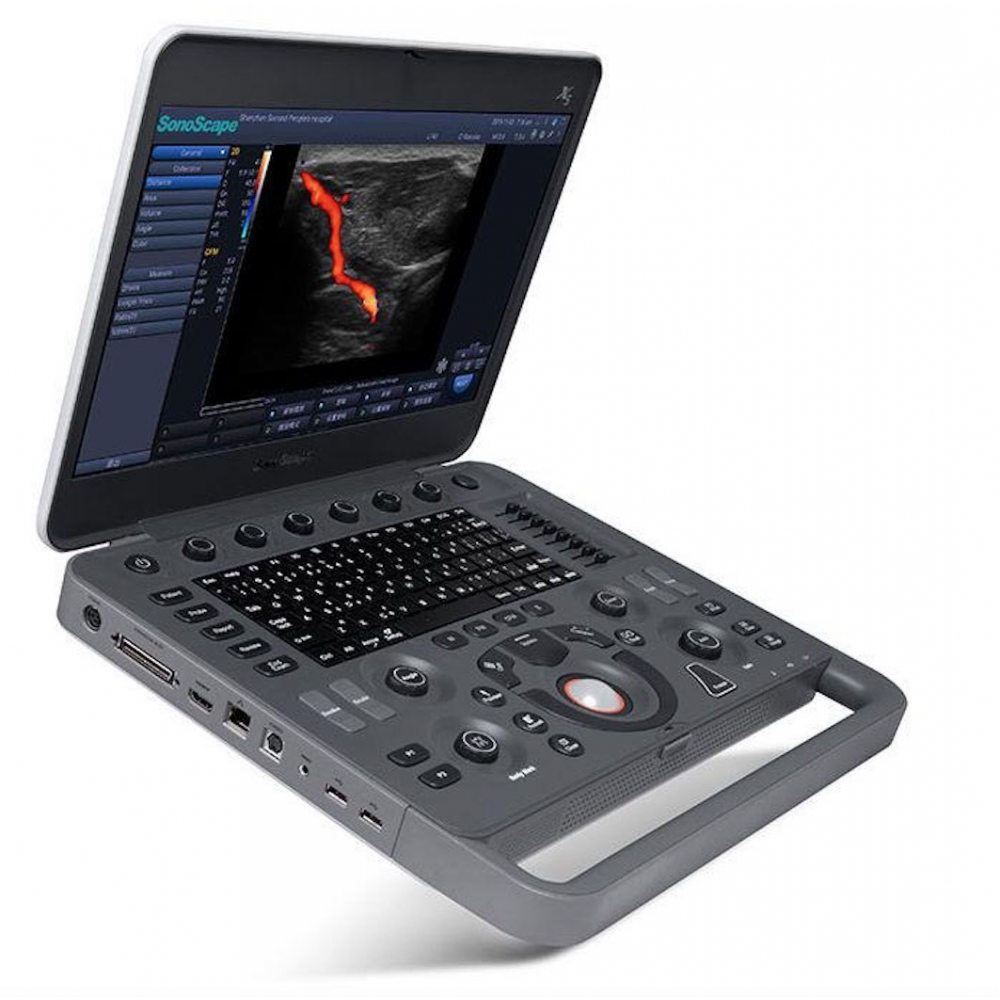 УЗИ аппарат SonoScape X5