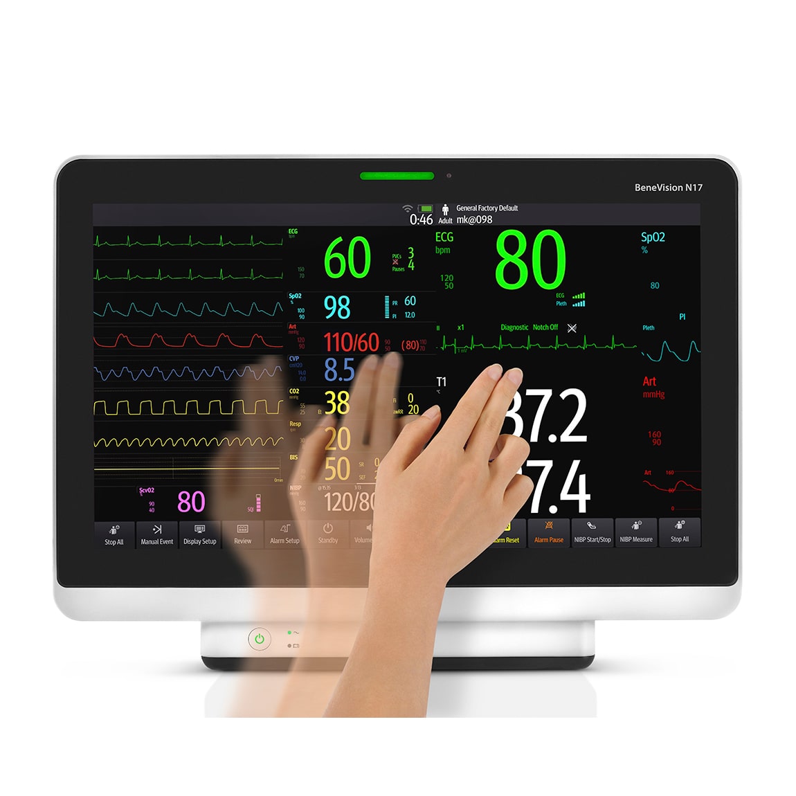 Монитор пациента Mindray BeneVision N17
