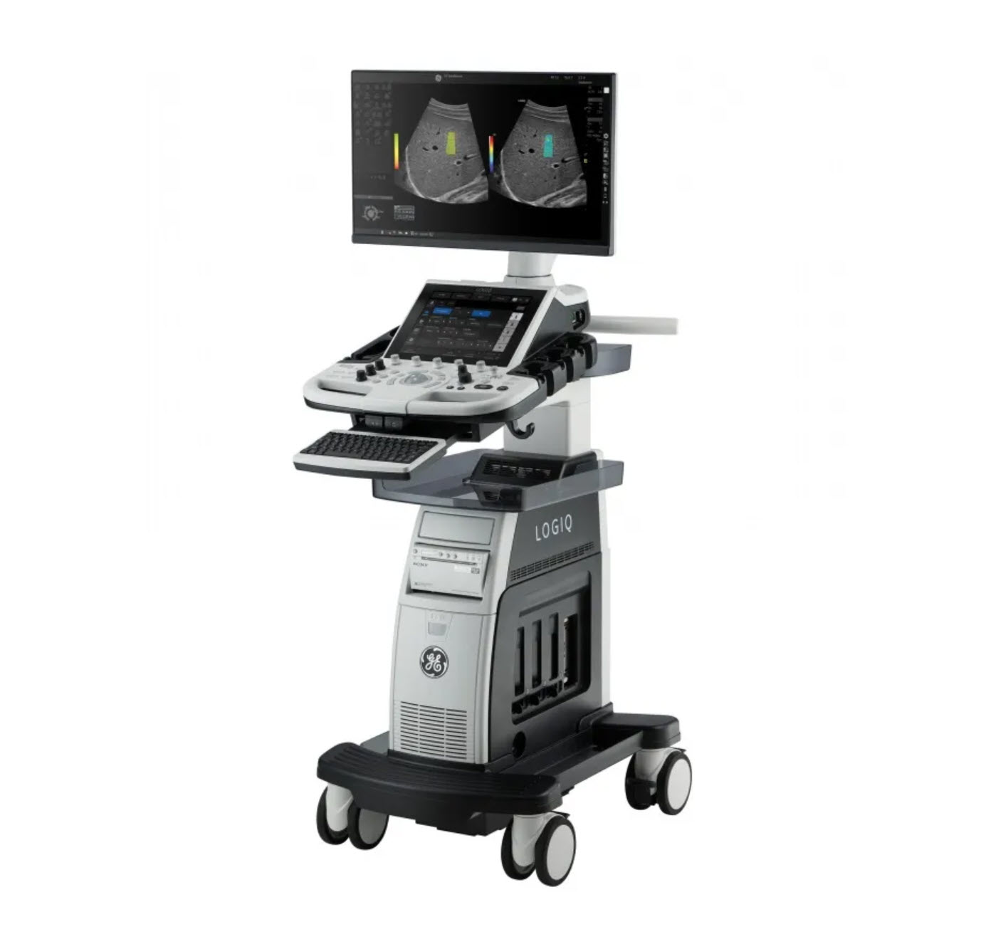УЗИ-аппарат GE HealthCare LOGIQ P10 XDclear
