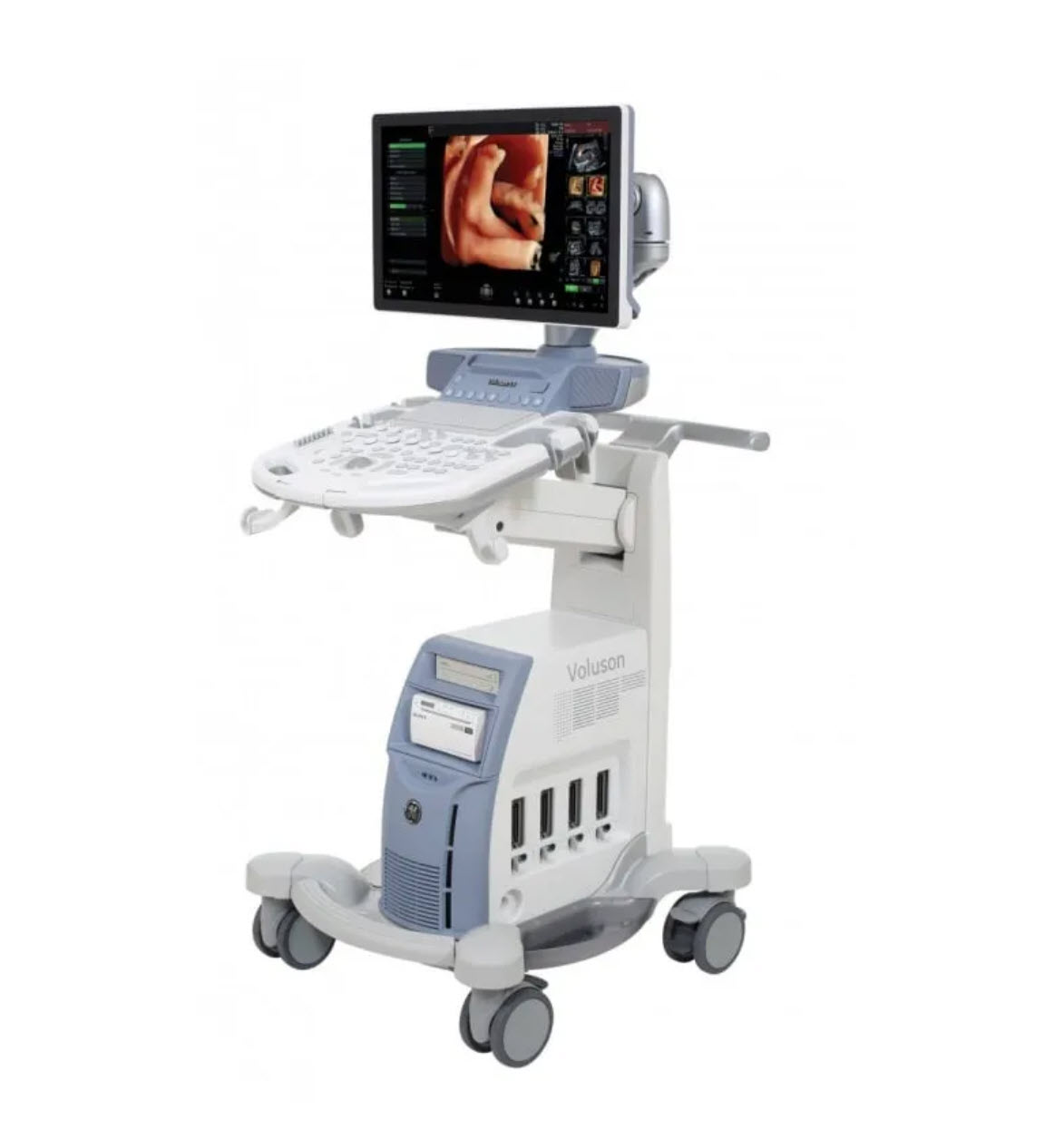 УЗИ-аппарат GE HealthCare Voluson S6